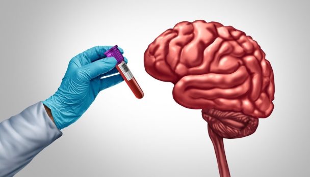 Alzheimer,Blood,Test,Diagnostics,And,Dementia,Screening,For,Early,Detection